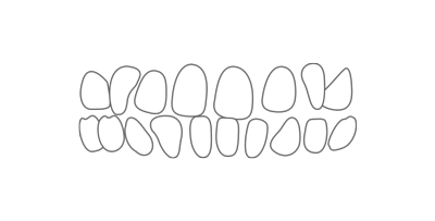 Ilustración de espacios entre dientes