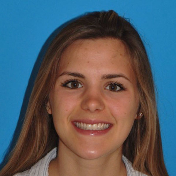 Caso Clínico de Paloma - Antes