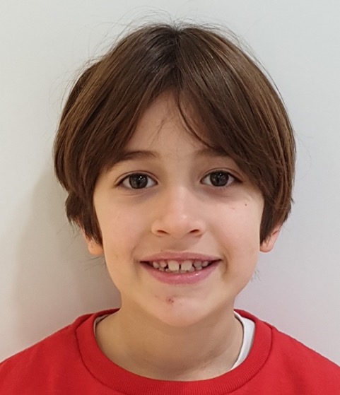 Caso clínico Matheo - Después