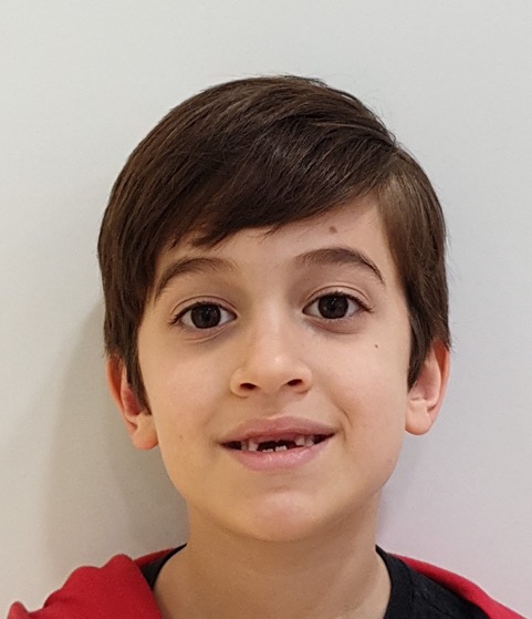 Caso clínico Matheo - Antes