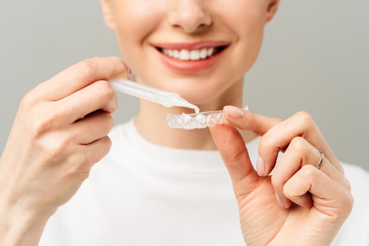 blanqueamiento-dental-casa