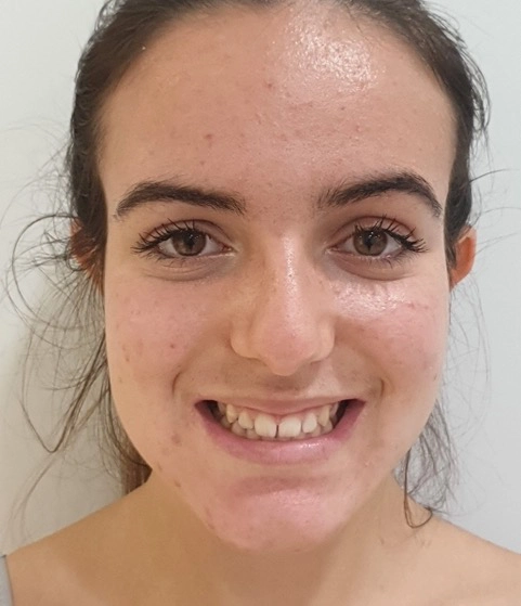 Caso clínico Lina - Inicio