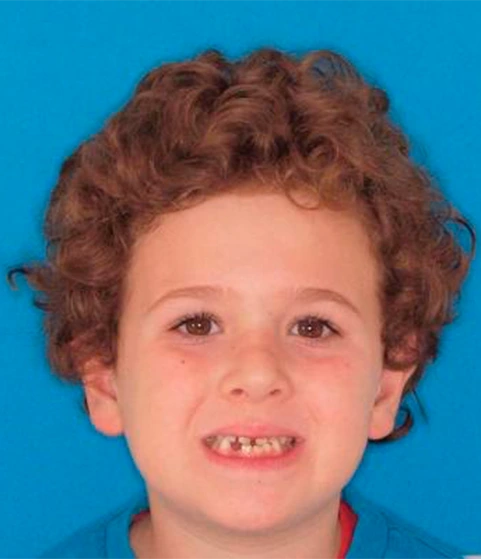 Caso clínico de Javier - inicio de primera fase