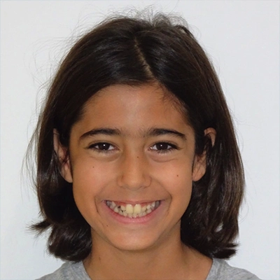 Caso clínico de Mateu - final de primera fase