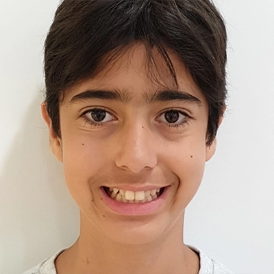 Caso clínico de Mateu - inicio de segunda fase