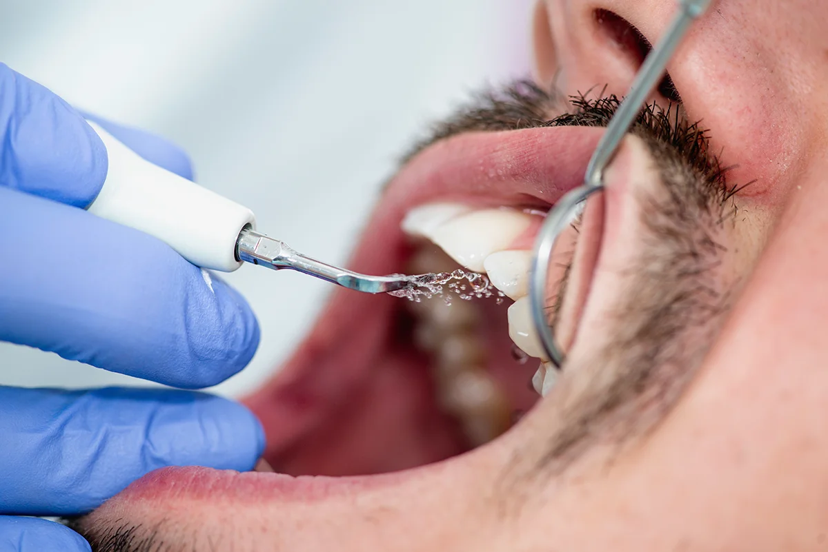 Higiene dental