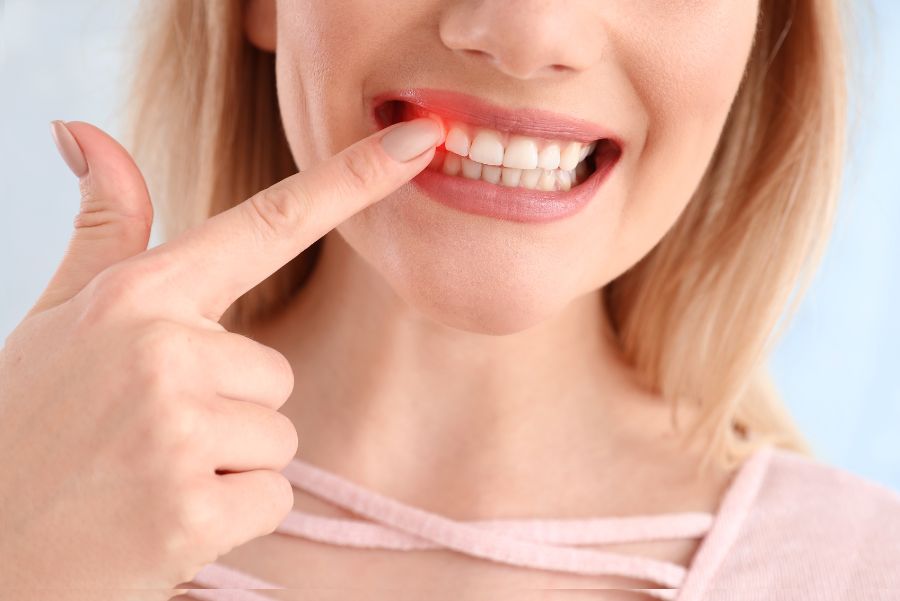 Enfermedad periodontal durante la adolescencia