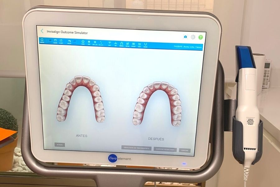 iTero ¡Última Tecnología en Ortodoncia!