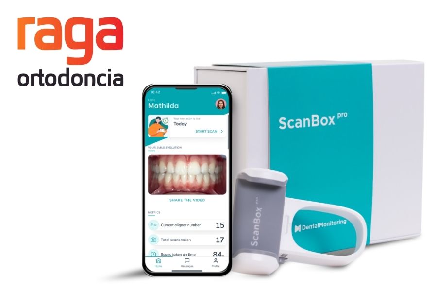 Dental Monitoring para control de Ortodoncia