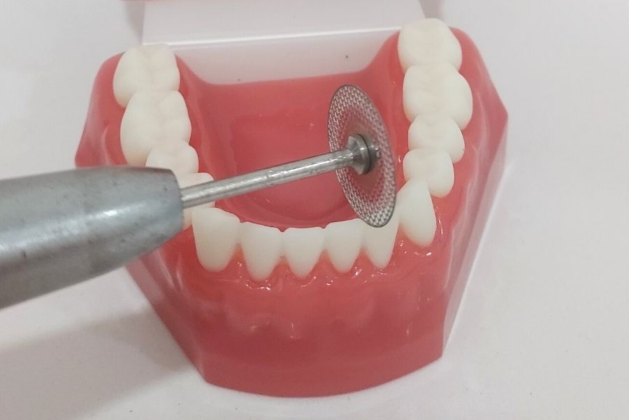 Stripping dental en Ortodoncia