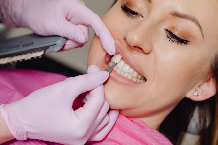 Carillas dentales ¿Qué opciones hay?