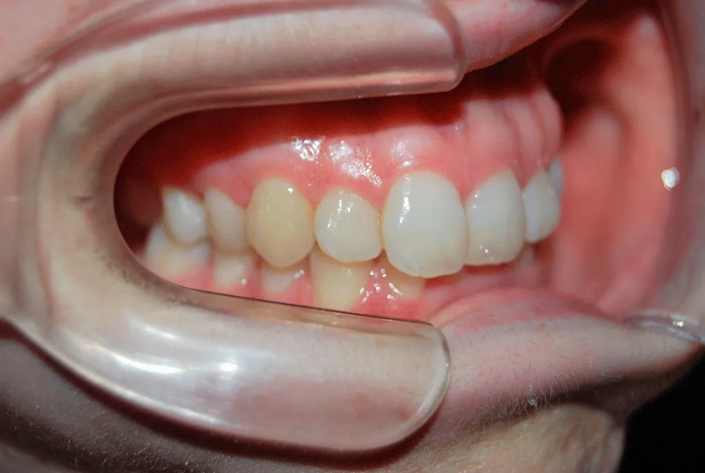 LATERAL-INICIAL sofia