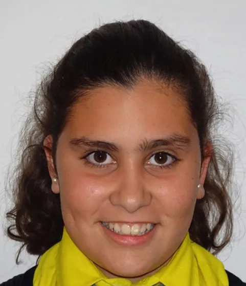 antes-claudia
