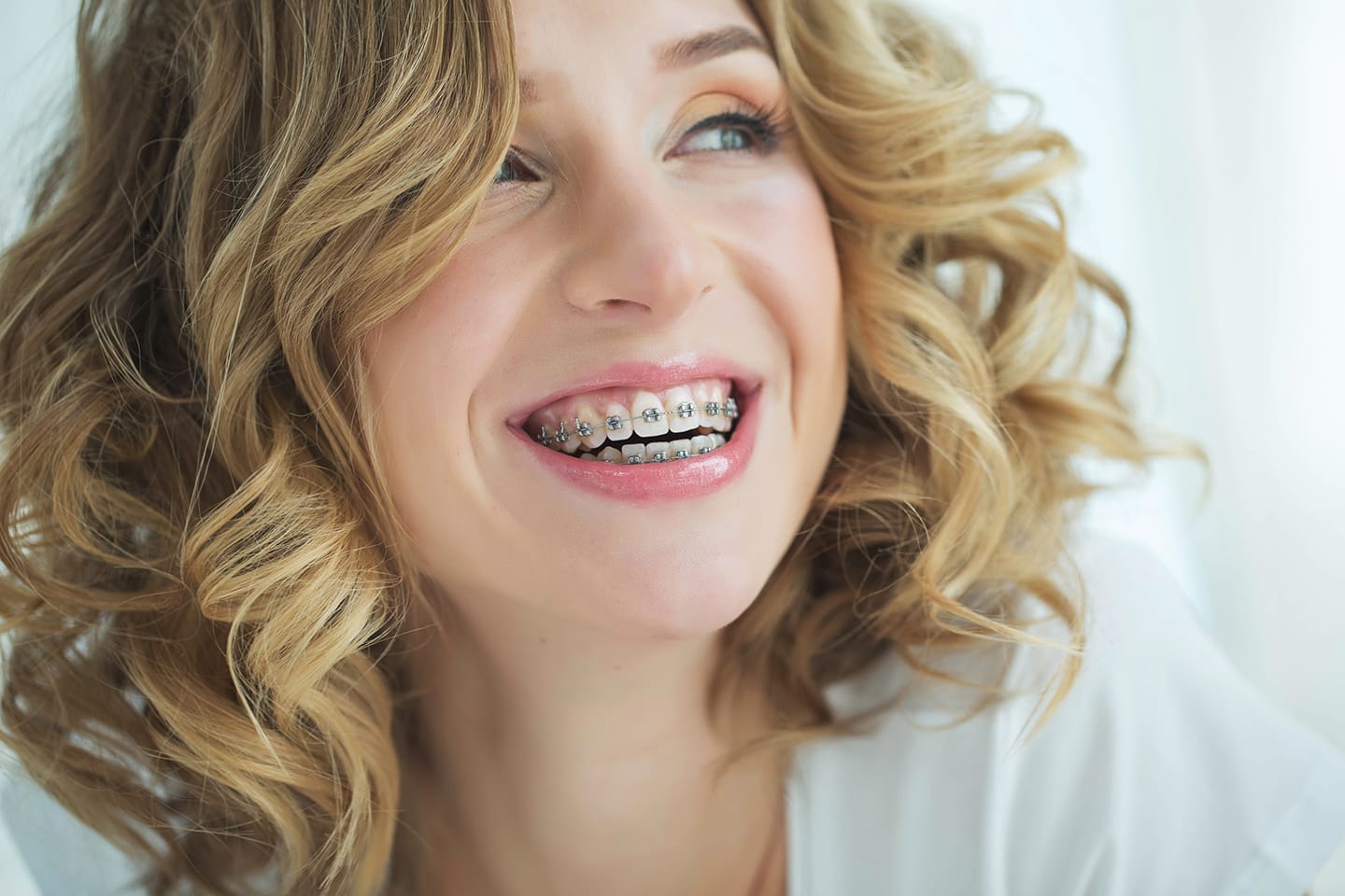 brackets autoligado