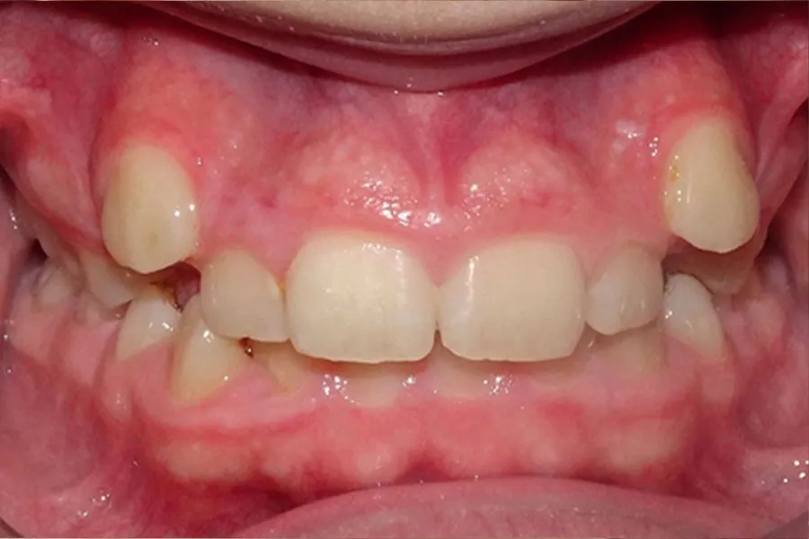caso-clinico-juan-frontal-inicio