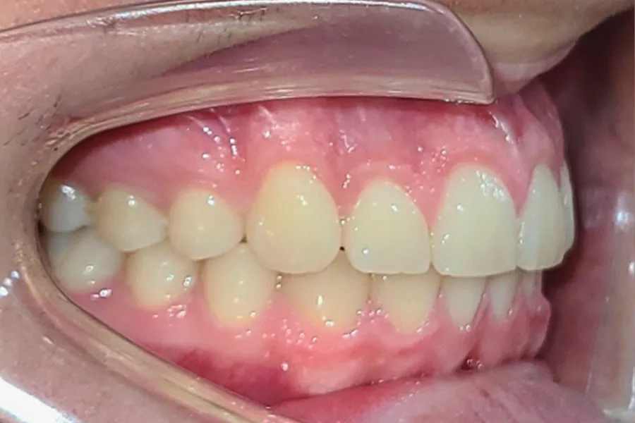 caso-juan-lateral-final1