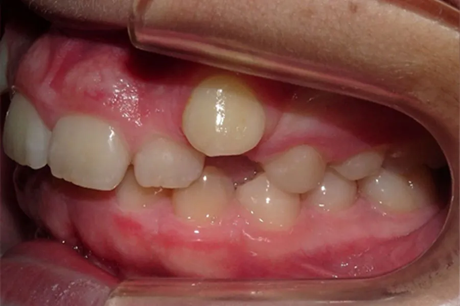 caso-juan-lateral-inicio2