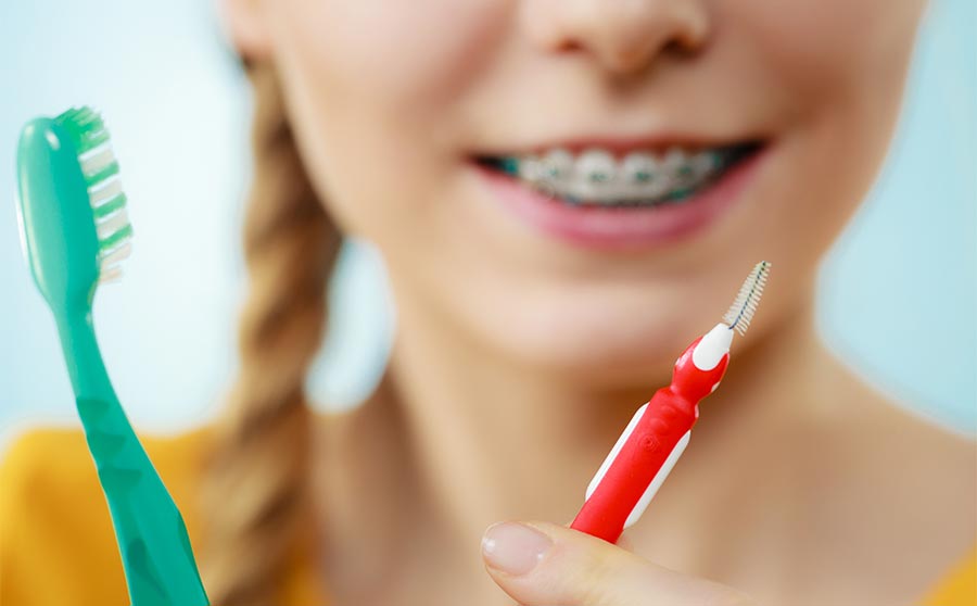 Qué cepillo para ortodoncia emplear si llevas brackets
