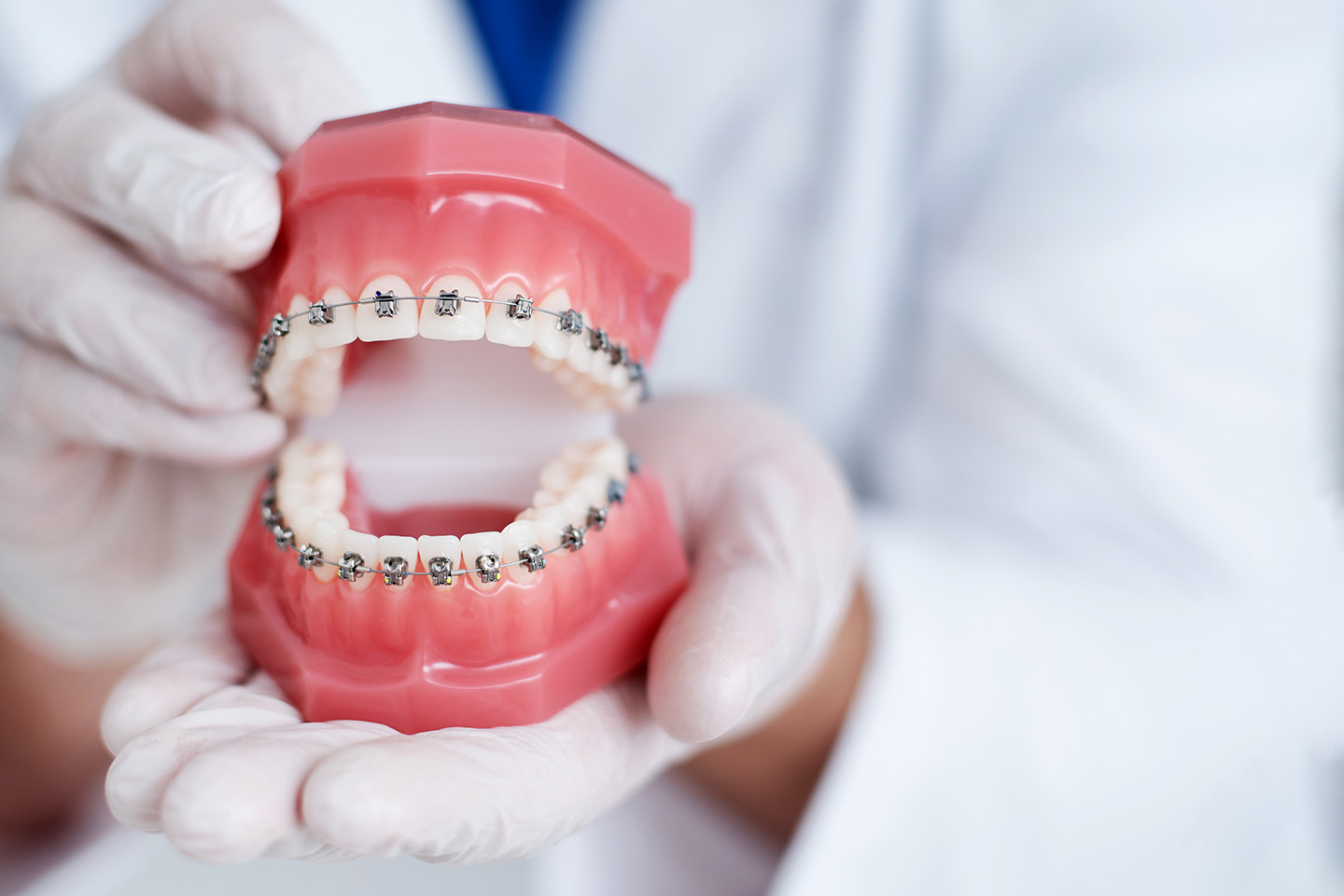 detectar-poner-brackets