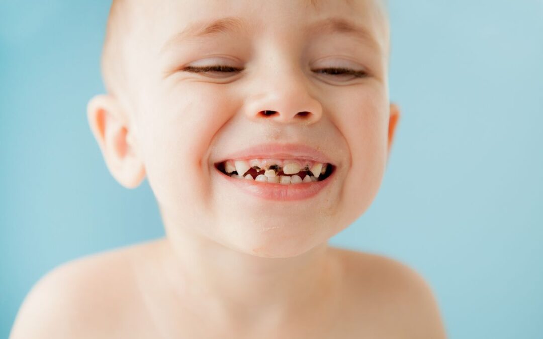 Dientes con caries en niños: todo lo que debes saber