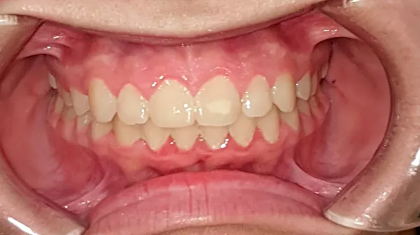 final-frontal-claudia