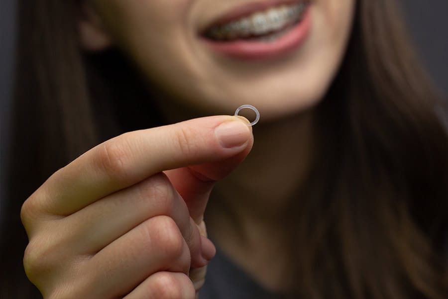 Gomas para brackets