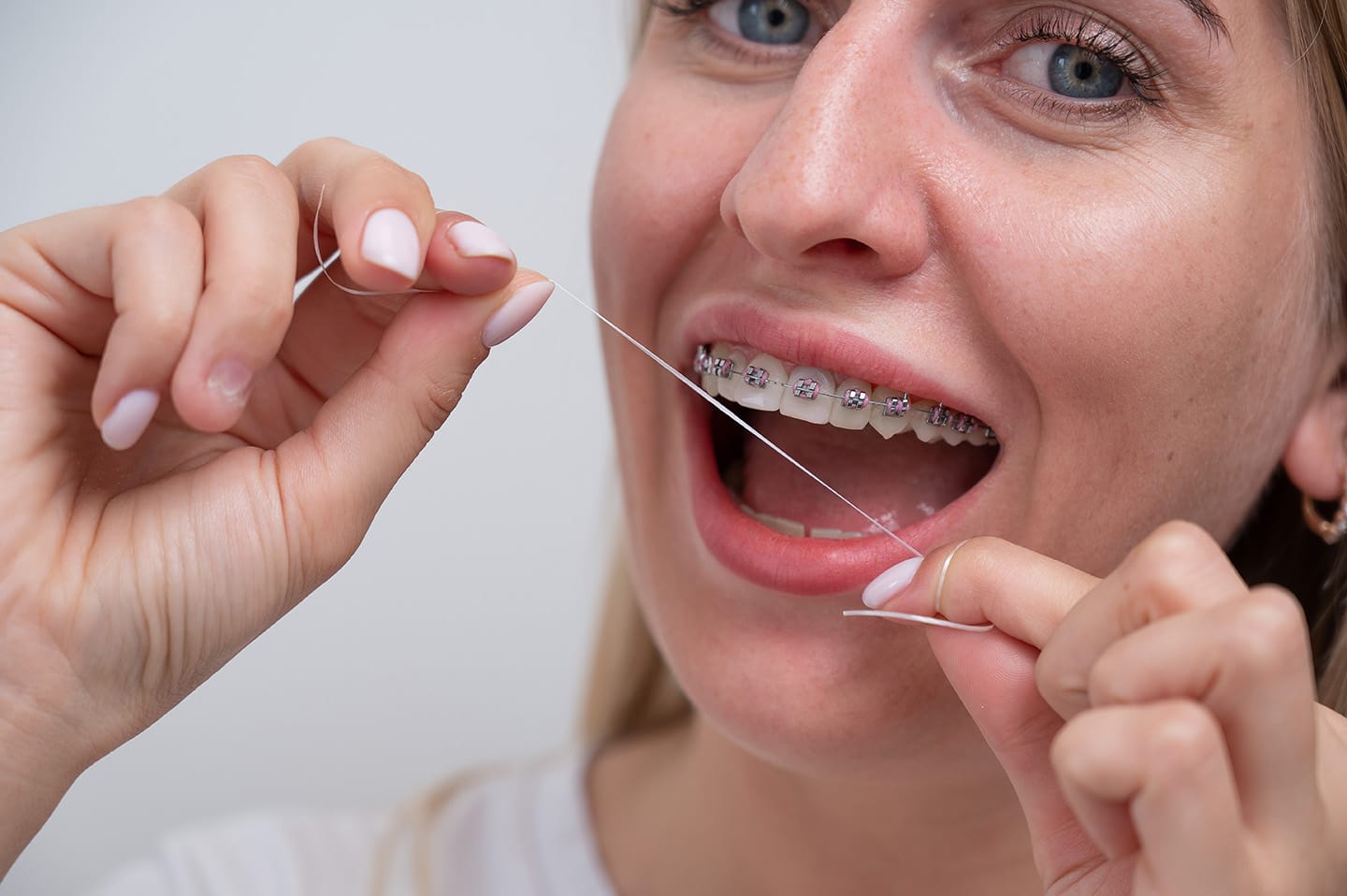 hilo-dental-limpiar-brackets