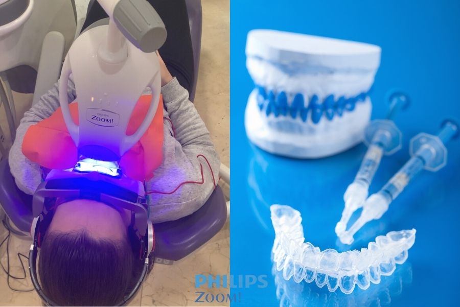 blanqueamiento dental