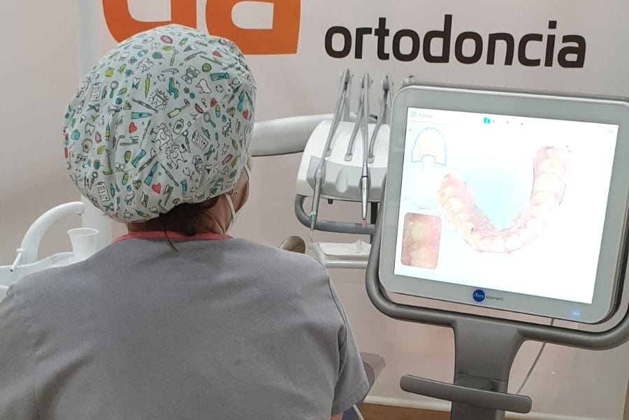 iTero escáner intraoral