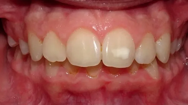 inicio-frontal-claudia