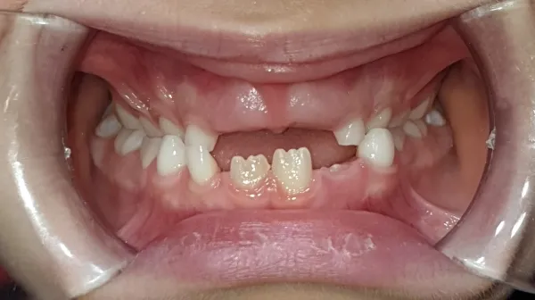 inicio_frontal matheo
