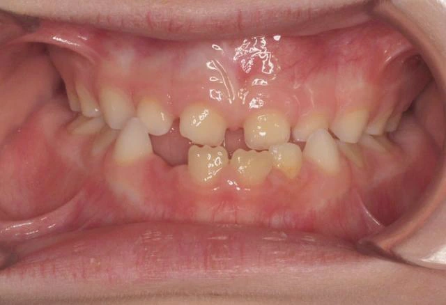 javier-gimeno-fase1-frontal-inicio