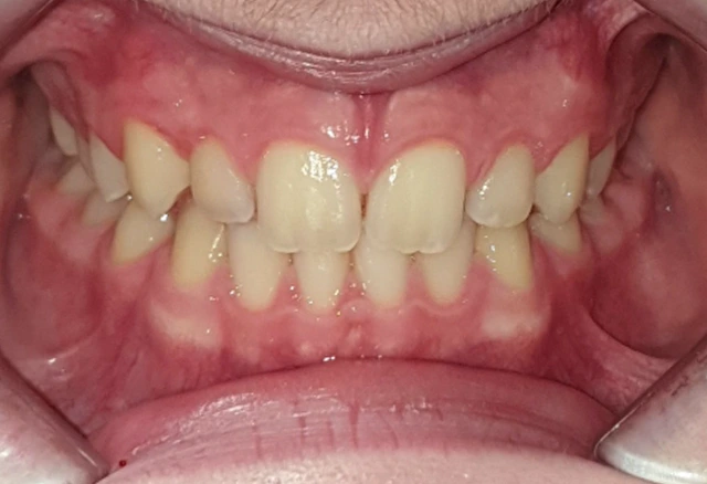 javier-gimeno-fase2-frontal-inicio
