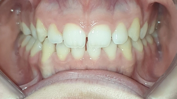 lina-inicio-frontal