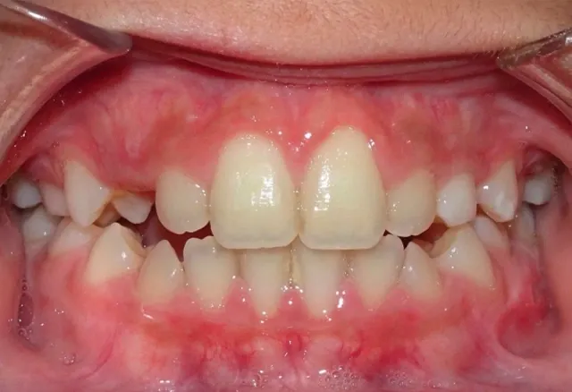 mateu-final-frontal-fase1