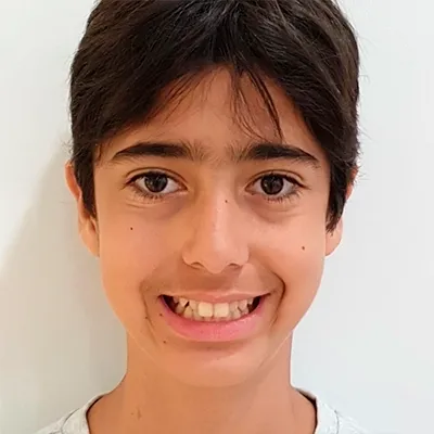 mateu-inicio_fase2