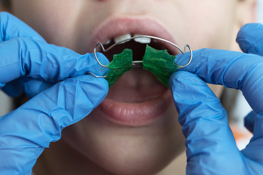 3 razones por las que tus hijos necesitan ortodoncia interceptiva